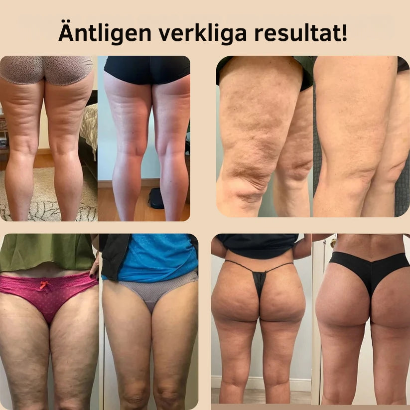 3D Anti Cellulite Leggings